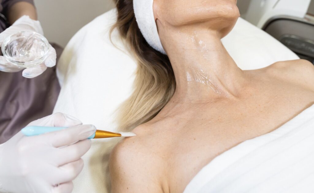 Fargo day spa chemical peels to treat the face and neck