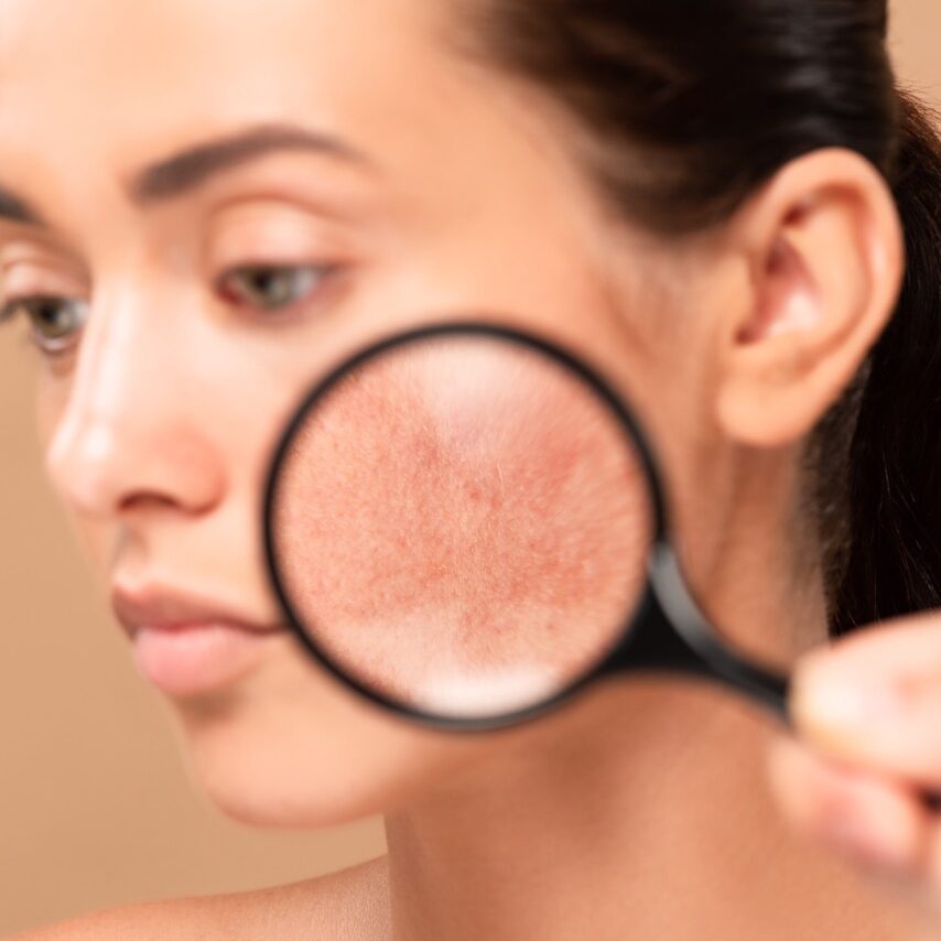 Problem skin? Visit our experienced estheticians at Uptown Haven Wellness Professional near Downtown Fargo