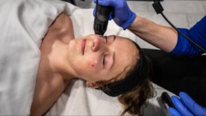 A client undergoing an acne facial treatment on a woman at a spa near Fargo ND