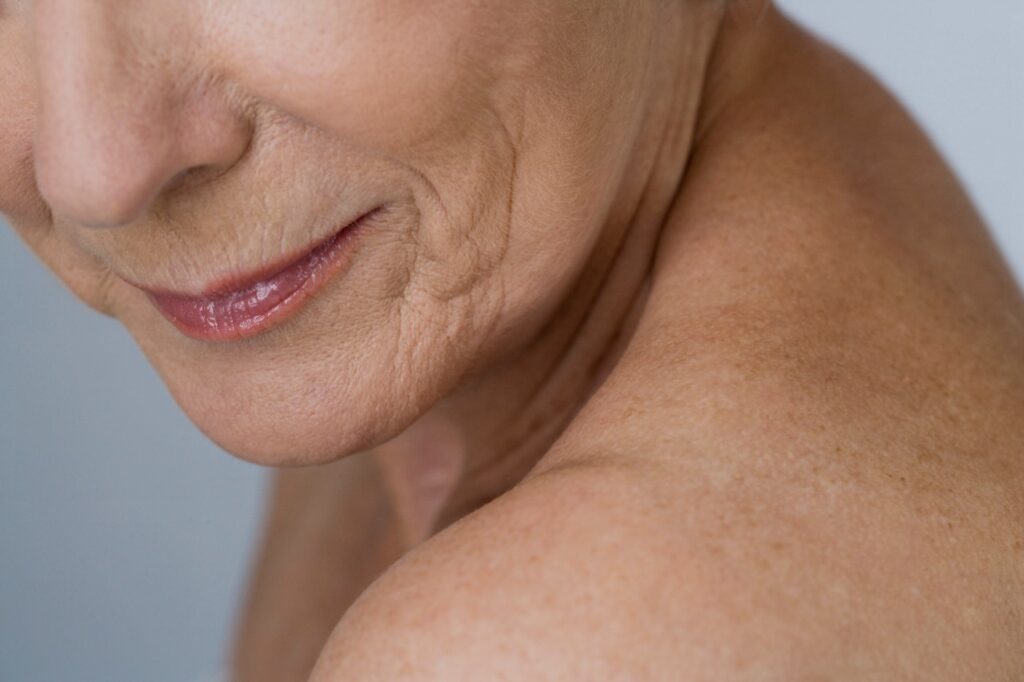 Carboxy Therapy for the Body