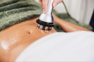 stomach undergoing skin tightening procedure