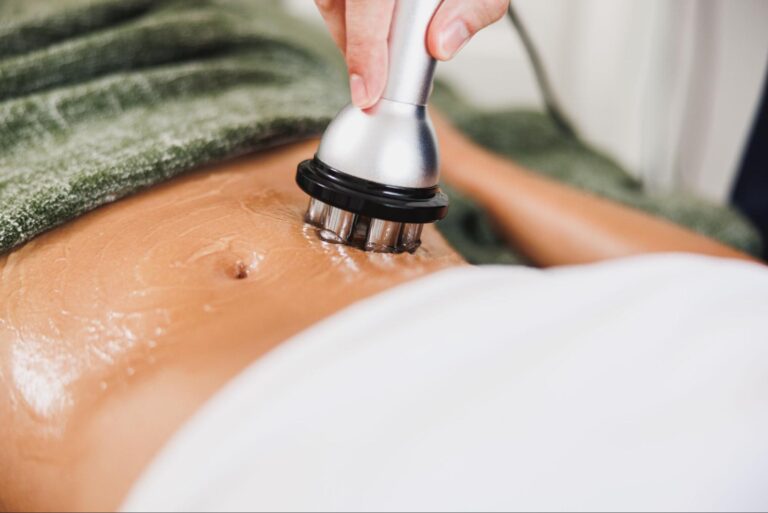 stomach undergoing skin tightening procedure